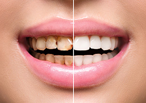 Endodontics